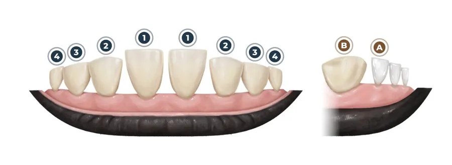 A arcada de baixo, dente por dente